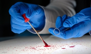 dłonie w niebieskich rękawiczkach z wymazówką i czerwoną substancją